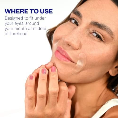 Microneedle Eye Patches for Dark Circles & Fine Lines – Under Eye Patches with Hyaluronic Acid, Collagen Boosting, Puffy Eye Treatment