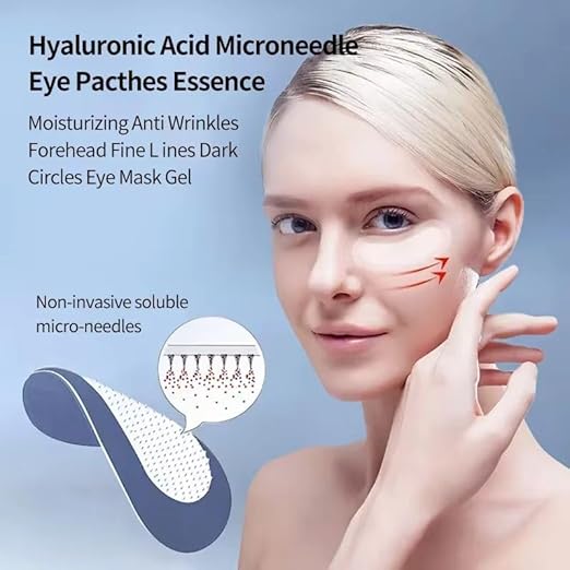 Microneedle Eye Patches for Dark Circles & Fine Lines – Under Eye Patches with Hyaluronic Acid, Collagen Boosting, Puffy Eye Treatment