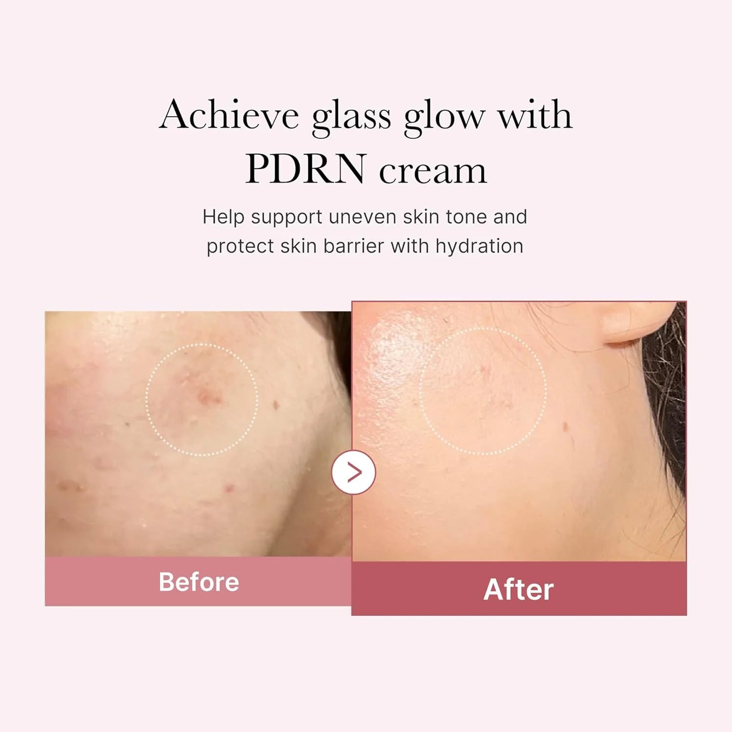 Medicube — PDRN Pink Hyaluronic Moisturizing Cream