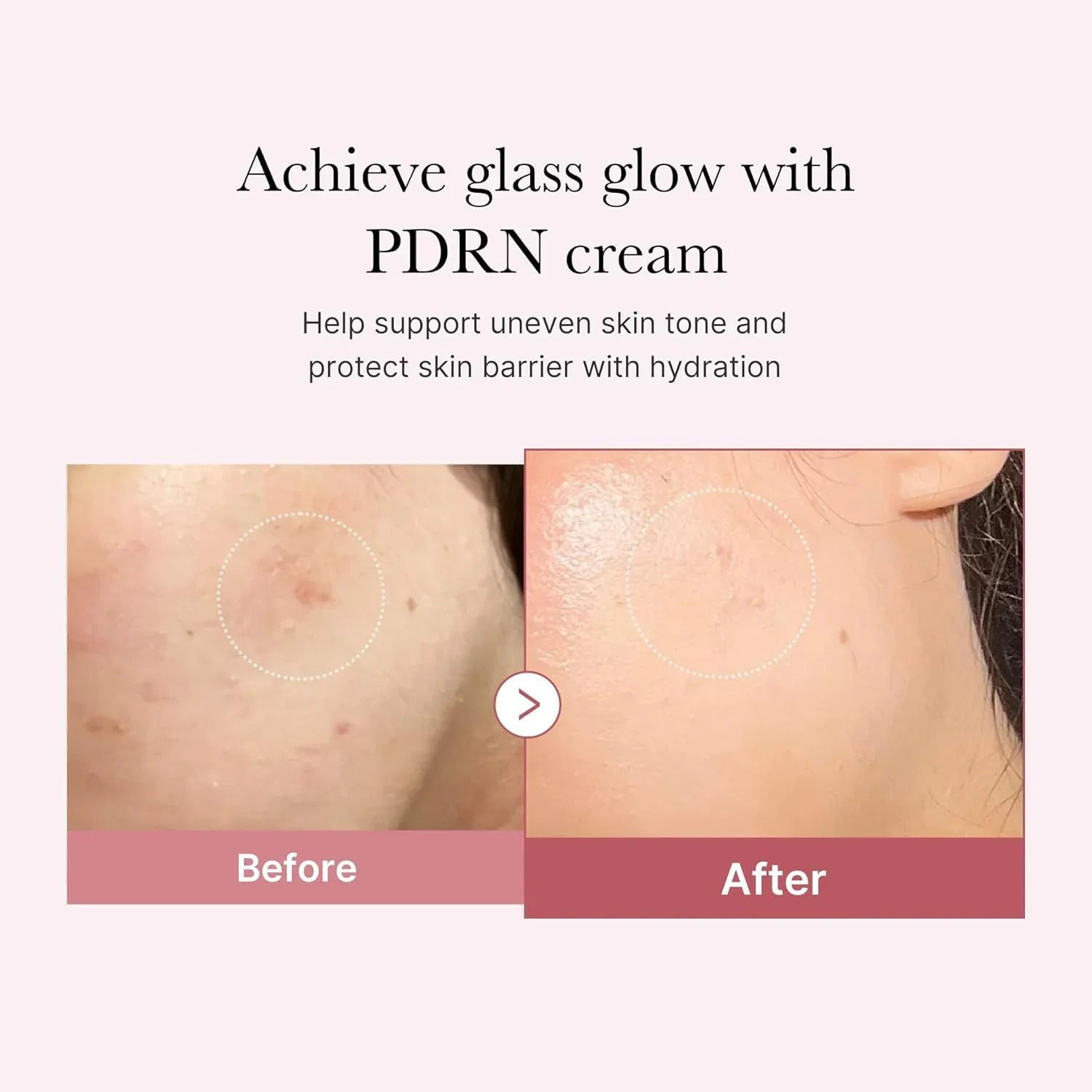 Medicube — PDRN Pink Hyaluronic Moisturizing Cream