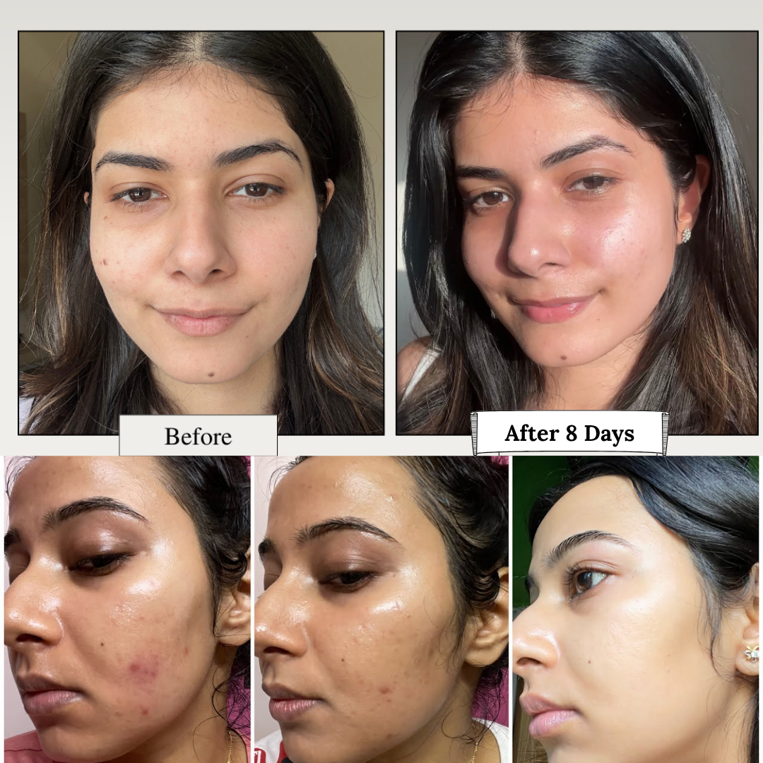 Dr.Althea 345 Relief Cream TikTok Viral Kbeauty