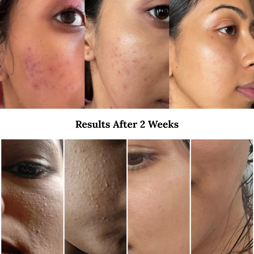 Dr.Althea 345 Relief Cream TikTok Viral Kbeauty