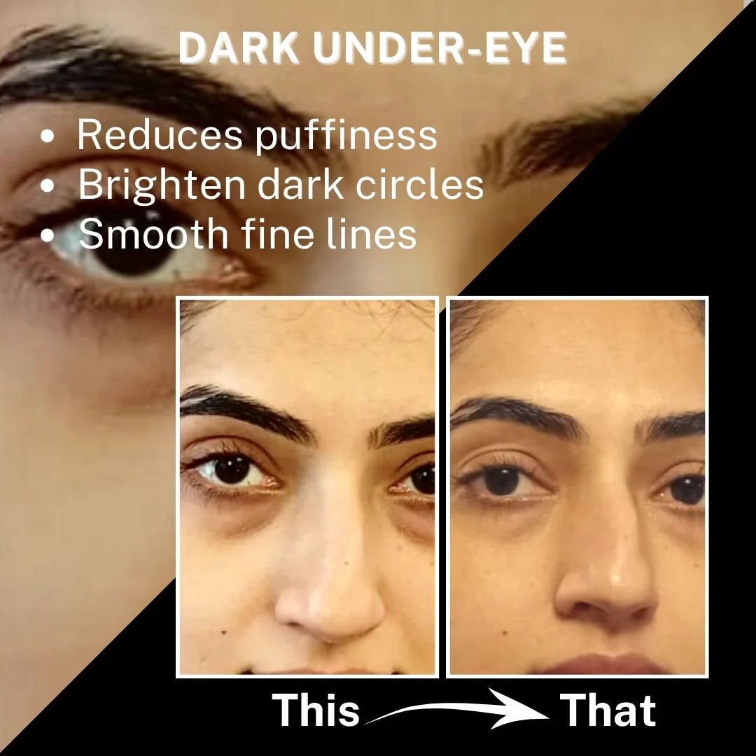 Celimax The Vita-A Retinal Shot Tightening Booster