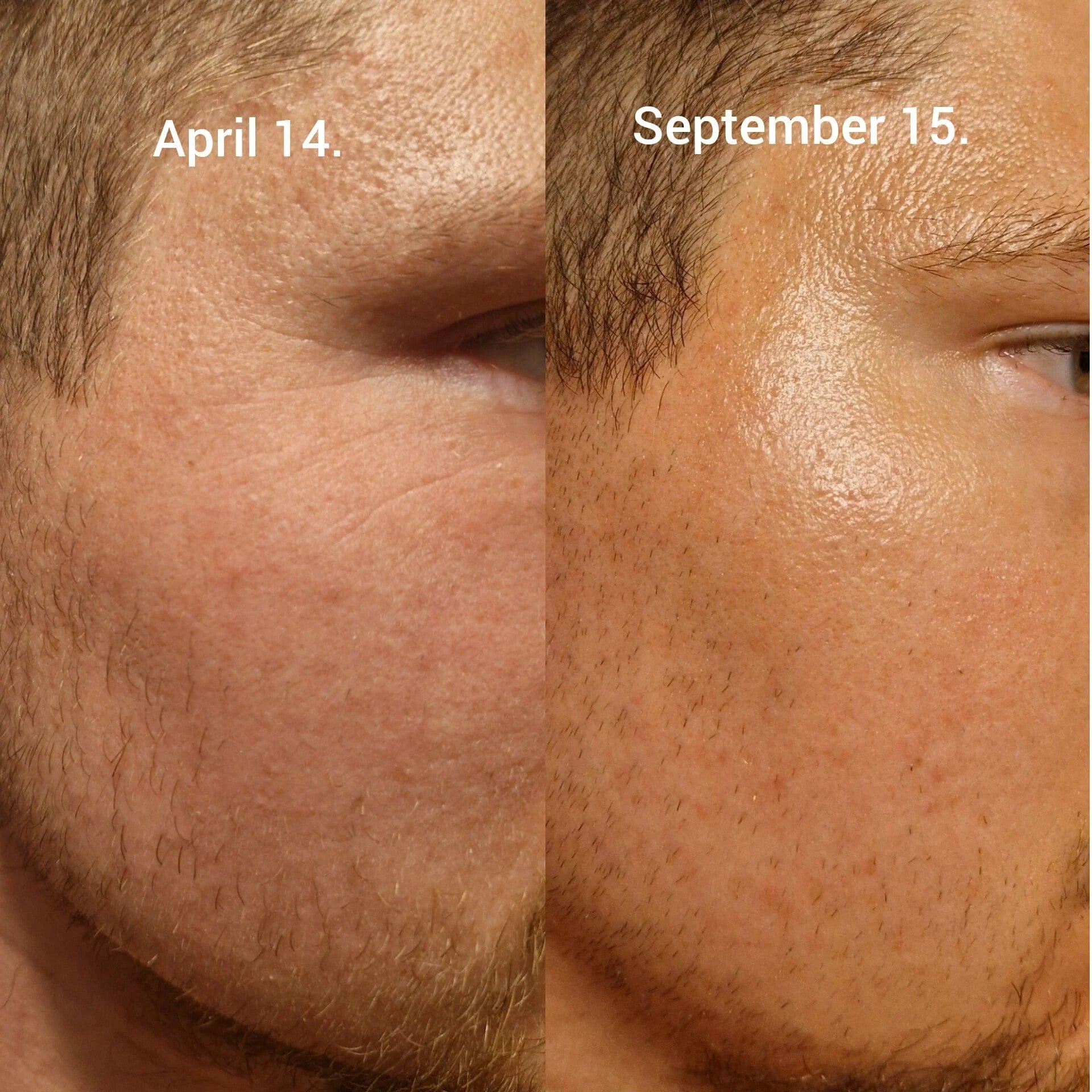 Celimax The Vita-A Retinal Shot Tightening Booster