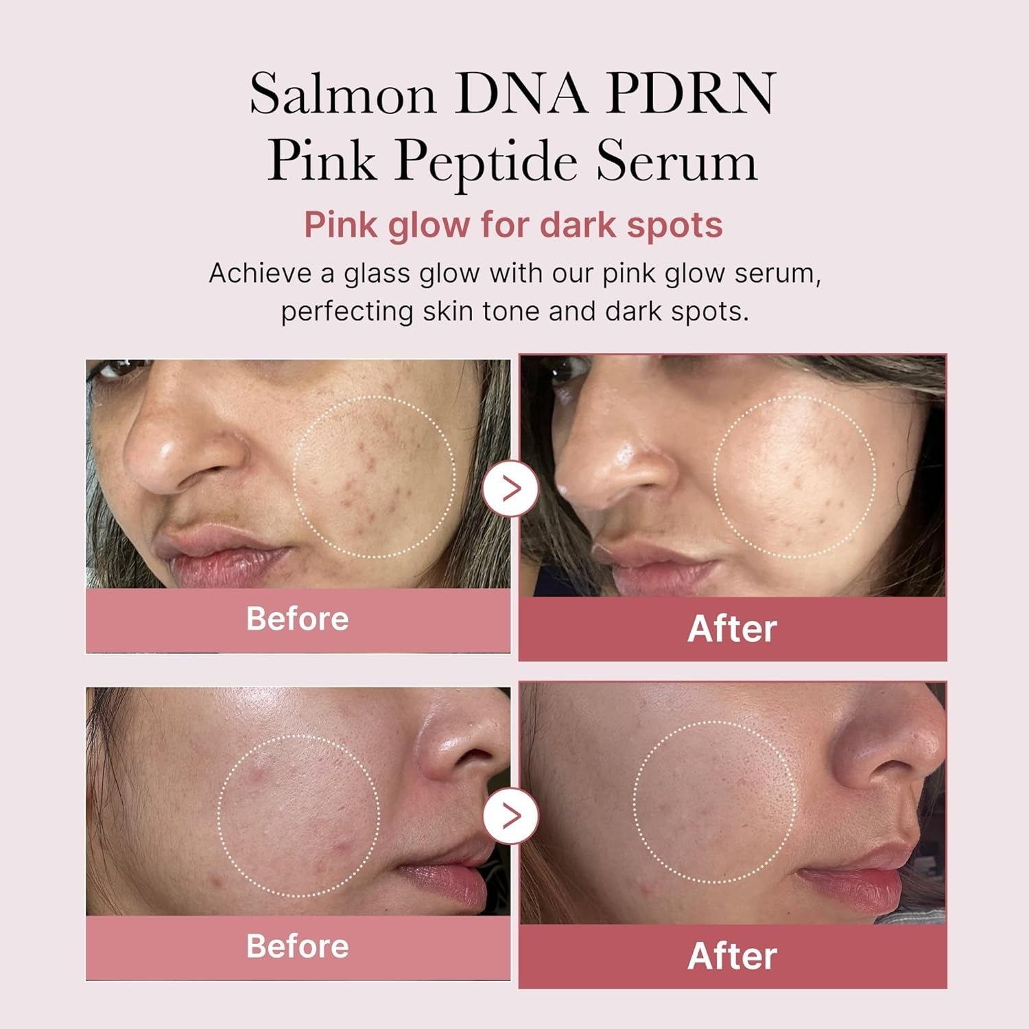 Medicube PDRN Pink Peptide Serum Now in India