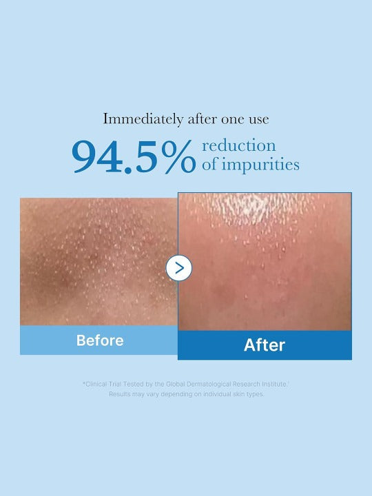 Medicube — Zero Pore Blackhead Deep Cleansing Oil