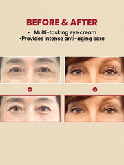 K-Secret Seoul 1988 Eye Cream - NOW IN INDIA