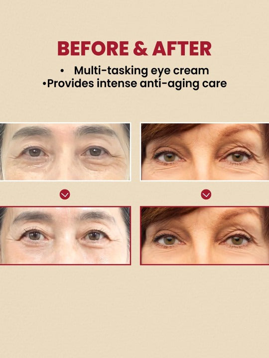 K-Secret Seoul 1988 Eye Cream - NOW IN INDIA